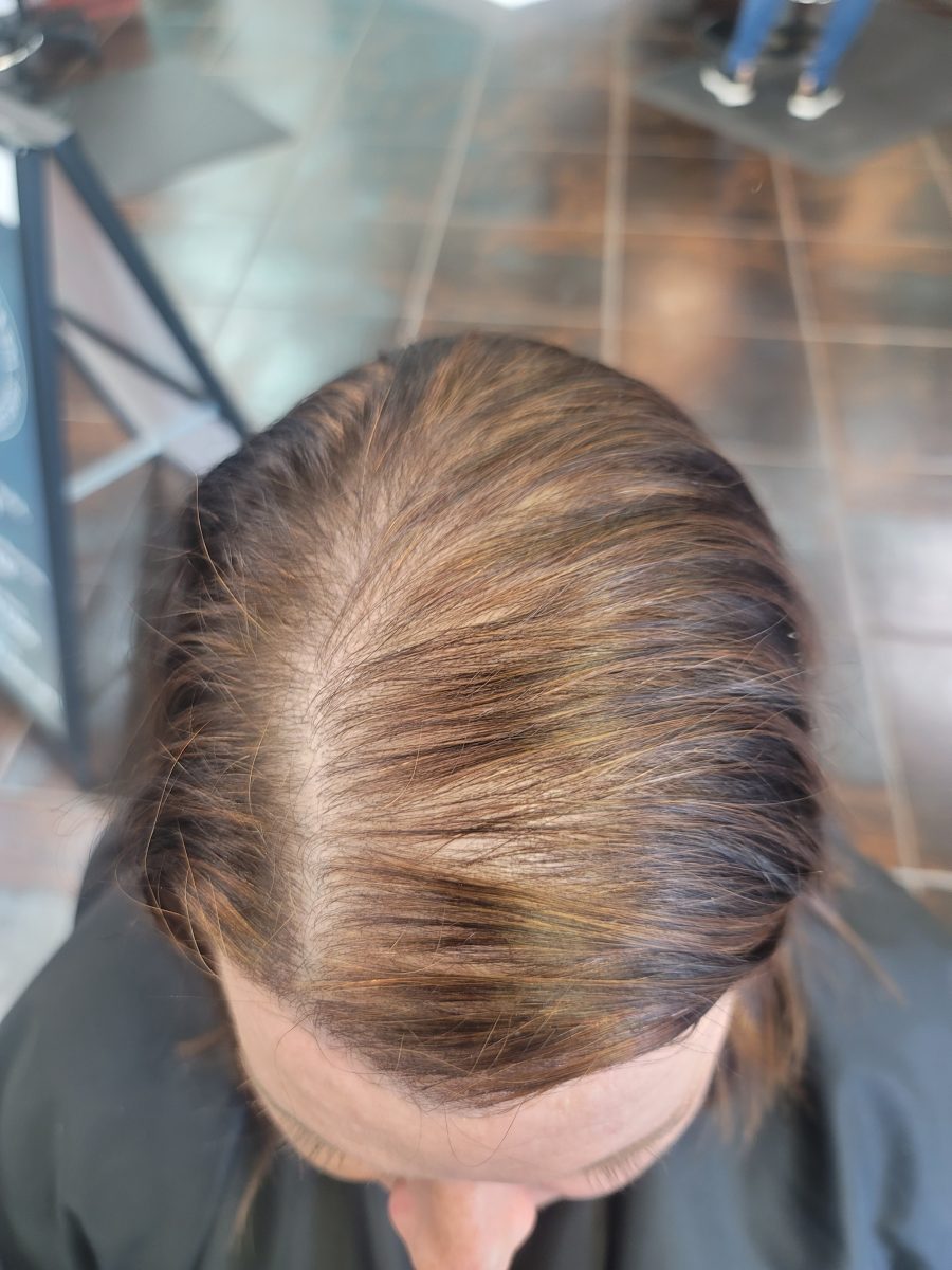 Before & After Topper before treatment by certified cranial prosthesis specialist Kristan Sayers at K Bella Hair Studio in Brighton, MI