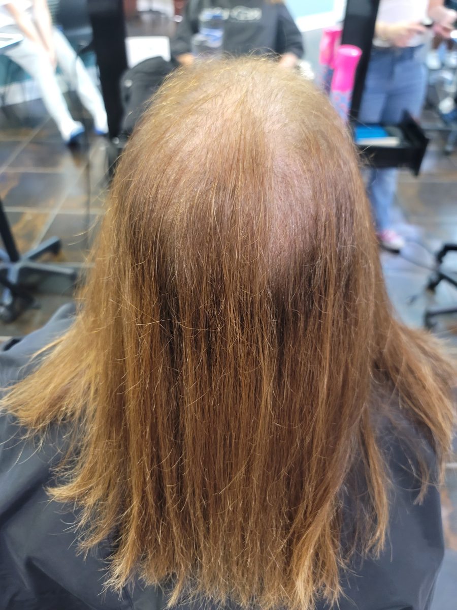 Before and After Topper Installation before treatment by certified cranial prosthesis specialist Kristan Sayers at K Bella Hair Studio in Brighton, MI