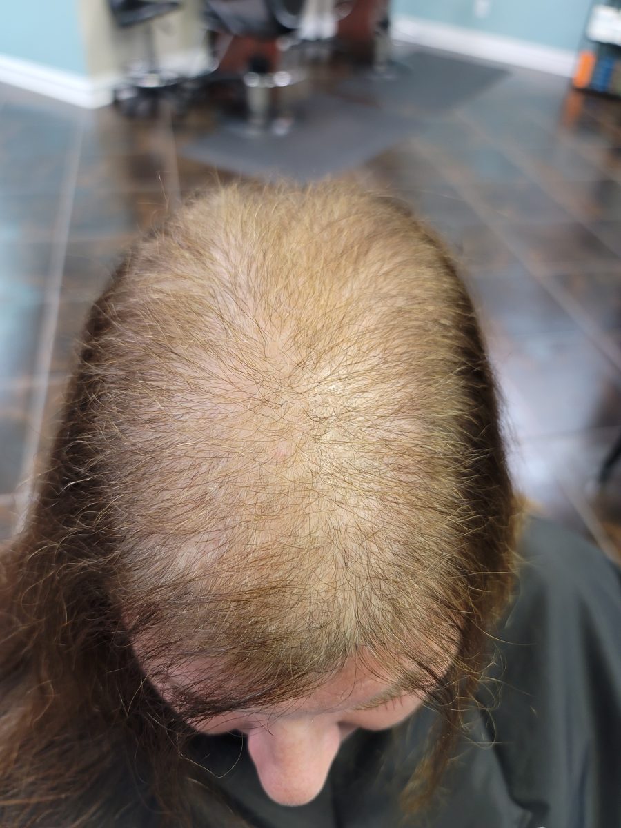Before and After Topper Installation before treatment by certified cranial prosthesis specialist Kristan Sayers at K Bella Hair Studio in Brighton, MI