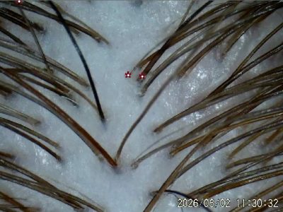 Close-up of treated scalp showing clear skin and healthy hair roots by Kristan Sayers at K Bella Hair Studio & Spa in Brighton, MI