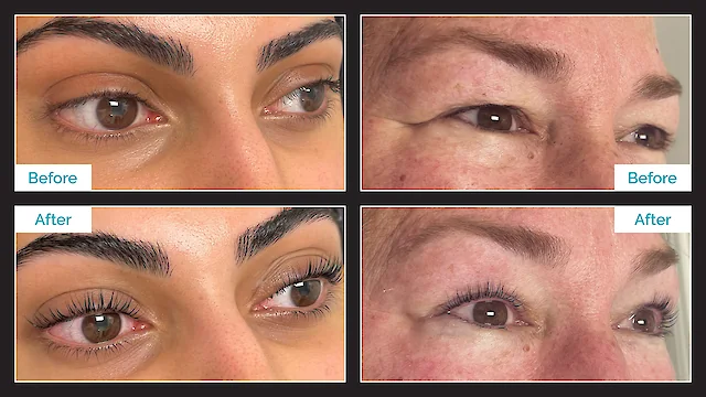 Lash Lift & Tint - Before & After - By Nada Toma