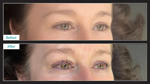 Lash Lift & Tint - Before & After