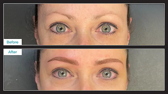 Eyebrow Microblading - Before & After