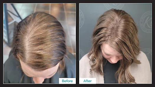 Before & After Topper