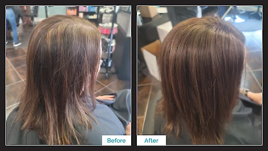 Topper Hair Replacement - Before & After