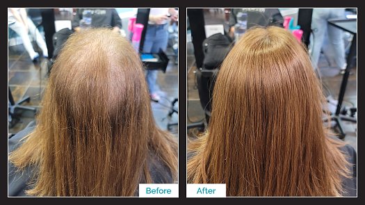 Hair Topper Transformation - Before & After - By Kristan Sayers | K Bella - Brighton, MI