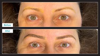 Eyebrow Microblading Before &amp; After